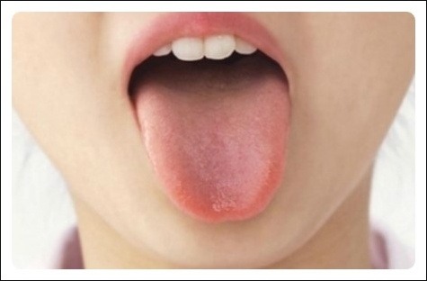 입냄새도 여러종류가있다! | 인스티즈