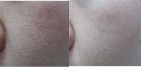 미앤미 피부관리 이미지