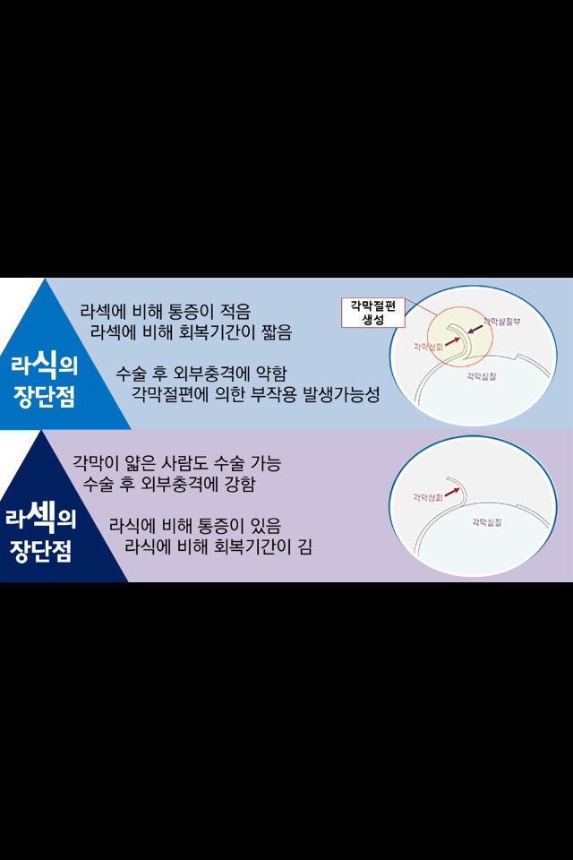 라섹과 라식의 차이 | 인스티즈