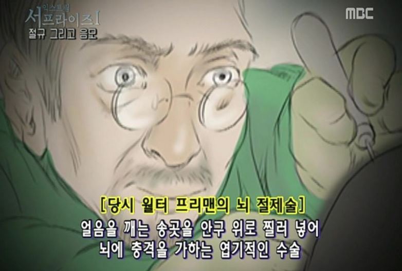 실제 생체실험 당했던 할리우드 여배우 | 인스티즈