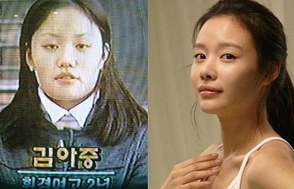 연예인 다이어트 전후 | 인스티즈