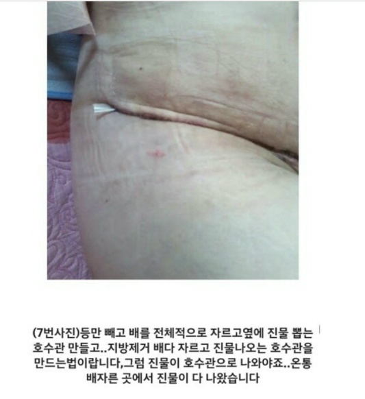 아래 글 사이코패스의사 성형 피해자들 사진 (심약자 주의!) | 인스티즈