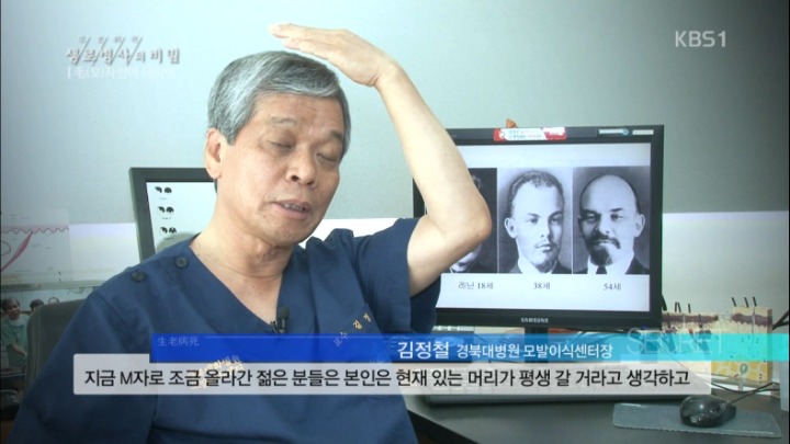 모발이식수술의 이면 | 인스티즈