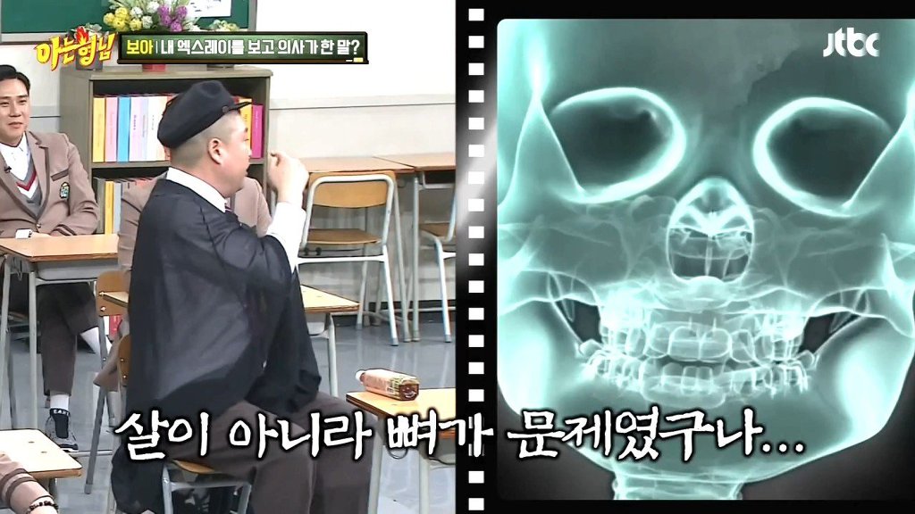 강호동이 엑스레이 찍고 깨달은 것 | 인스티즈